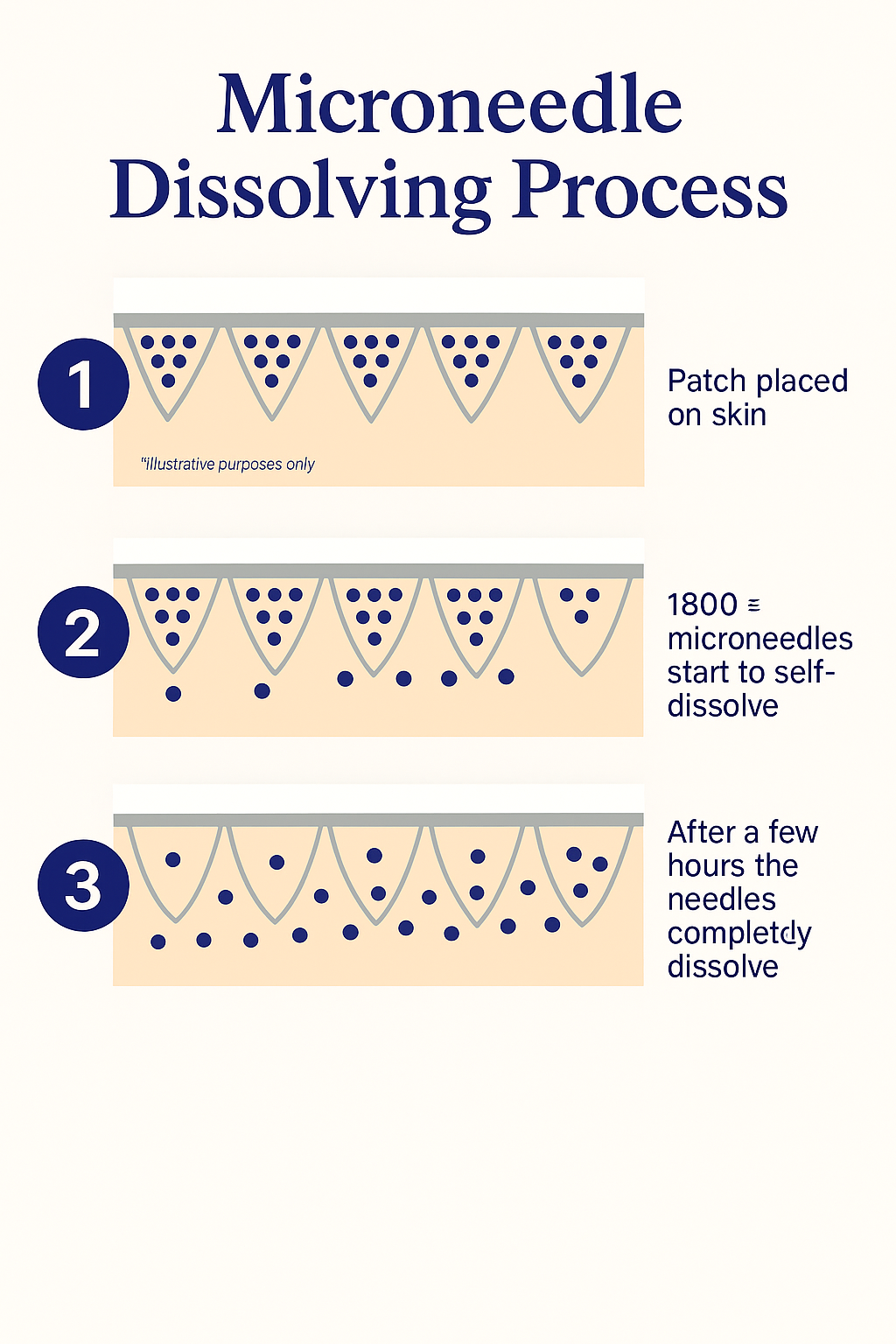 Nuvia™  Dissolving Micro needle Eye Patches